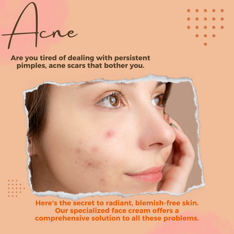 JoyPretty Acne Face Cream Pimple Treatment Tea Tree Anti-inflammatory Acne Scars Clear Pore Moisturiz Facial Creams Skin Care